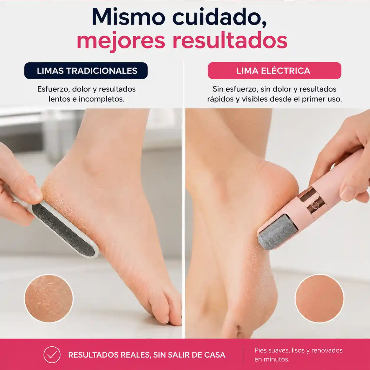 Removedor Callos Eléctrico Recargable TaloSilk™